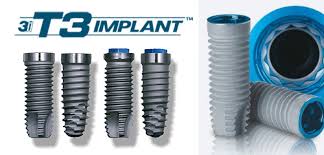 Implantes Implantes